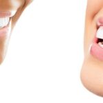 Exploring the Top Teeth Whitening Clinics in Rancho Bernardo